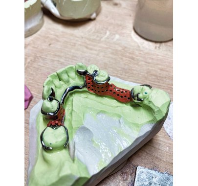 Châssis métallique