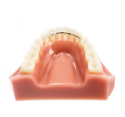 Fils orthodontiques (cab)
