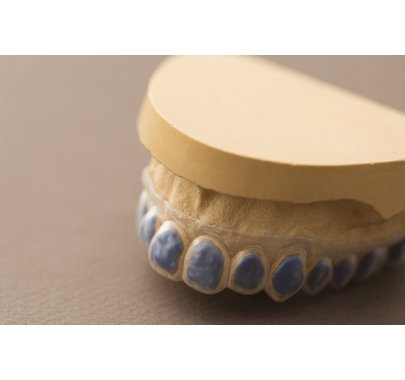 Gouttière pour blanchiment