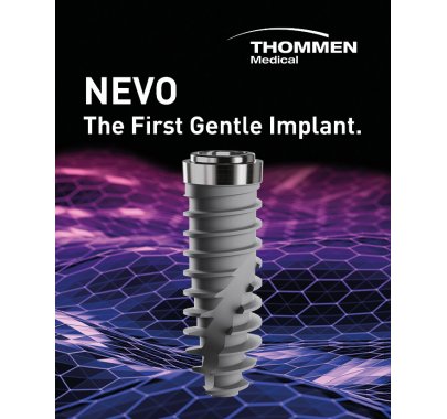 Implants