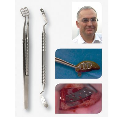 Instruments pour la chirurgie implantaire