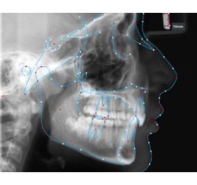 Logiciels d'aide au diagnostic