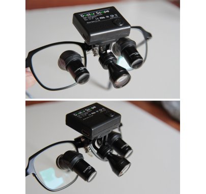 Loupes binoculaires (lab)