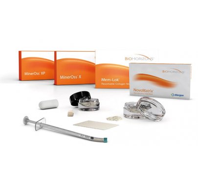 Matériaux de comblement/de reconstruction osseuse-régénération tissulaire