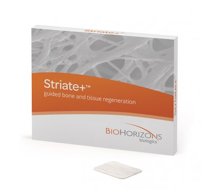 Matériaux de comblement/de reconstruction osseuse-régénération tissulaire