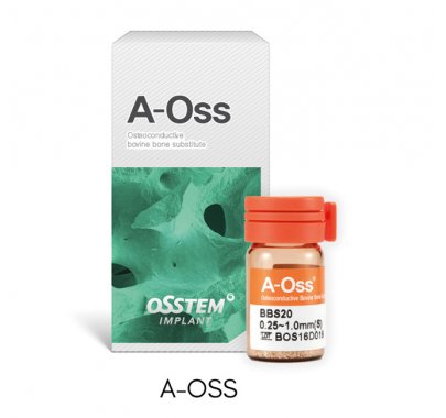 Matériaux de régénération osseuse (implantologie)