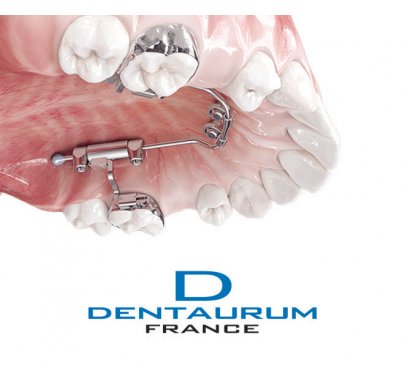 Mini-vis orthodontique