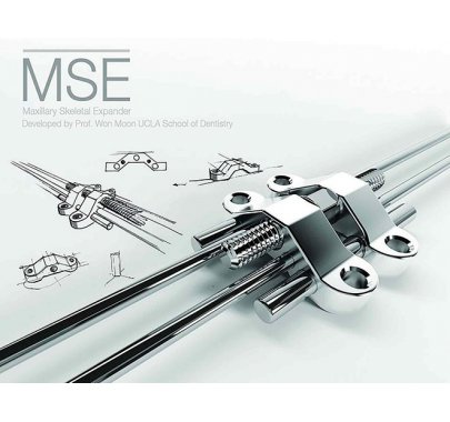 Mini-vis orthodontique