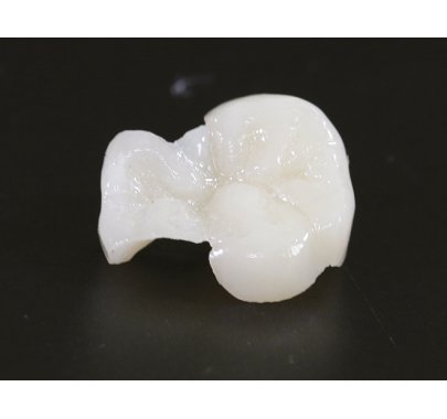 Prothèse conjointe composite