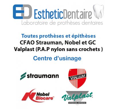 Prothèse partielle métallique adjointe