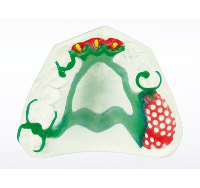 Revêtements compensateurs pour prothèse mobile